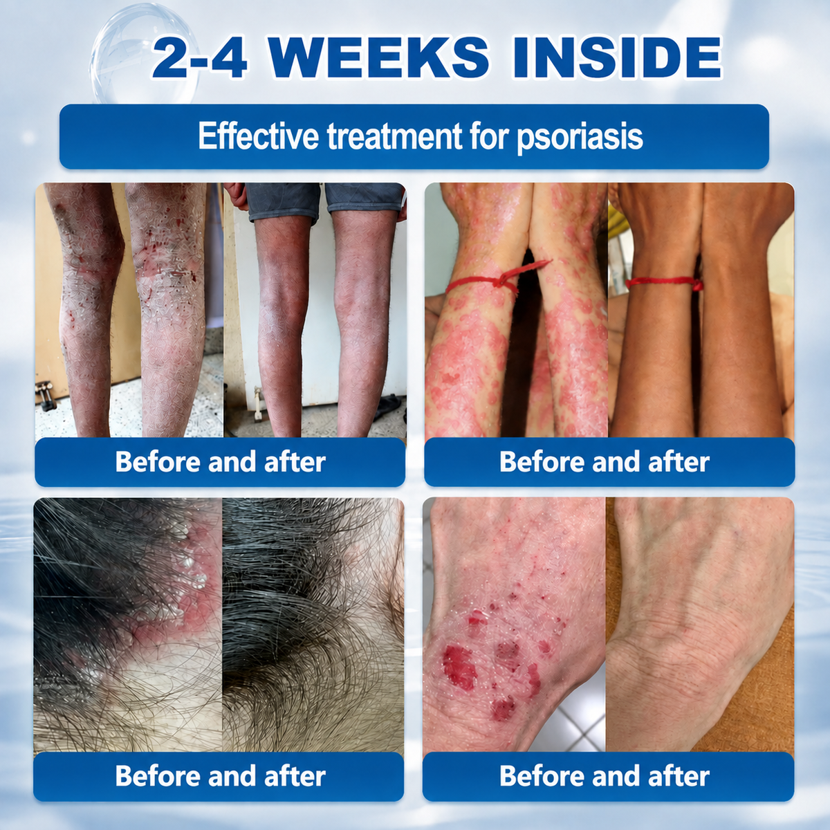 🎊🎊 Clinclii® 𝟕-𝐃𝐚𝐲 𝐒𝐤𝐢𝐧 𝐓𝐚𝐠 & 𝐒𝐩𝐨𝐭 𝐄𝐫𝐚𝐬𝐞𝐫 𝐂𝐫𝐞𝐚𝐦 (𝐙𝐞𝐫𝐨 𝐏𝐚𝐢𝐧, 𝐙𝐞𝐫𝐨 𝐒𝐜𝐚𝐫𝐬 𝐅𝐨𝐫𝐦𝐮𝐥𝐚)