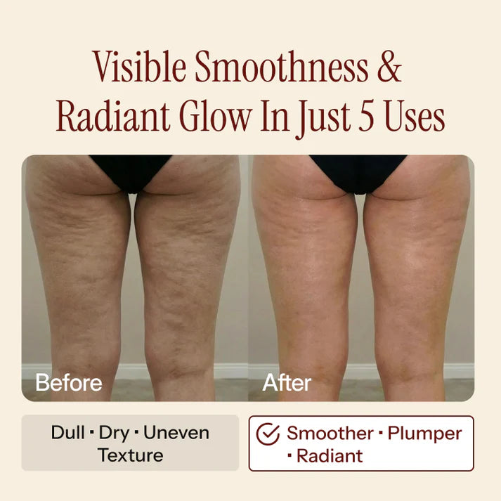 Before and after comparison showing smoother-looking thigh skin
