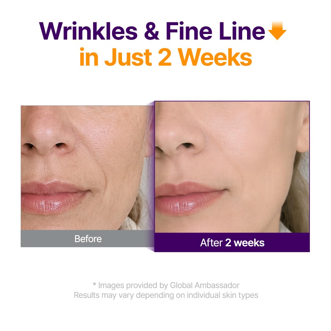 JAXVOLT Retinol + Retinal Firming Serum for Fine Lines & Smoother-Looking Skin