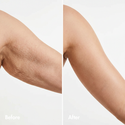🔥LAST DAY Buy 1 Get 1 Free🔥REVERSE-AGING BODY OIL