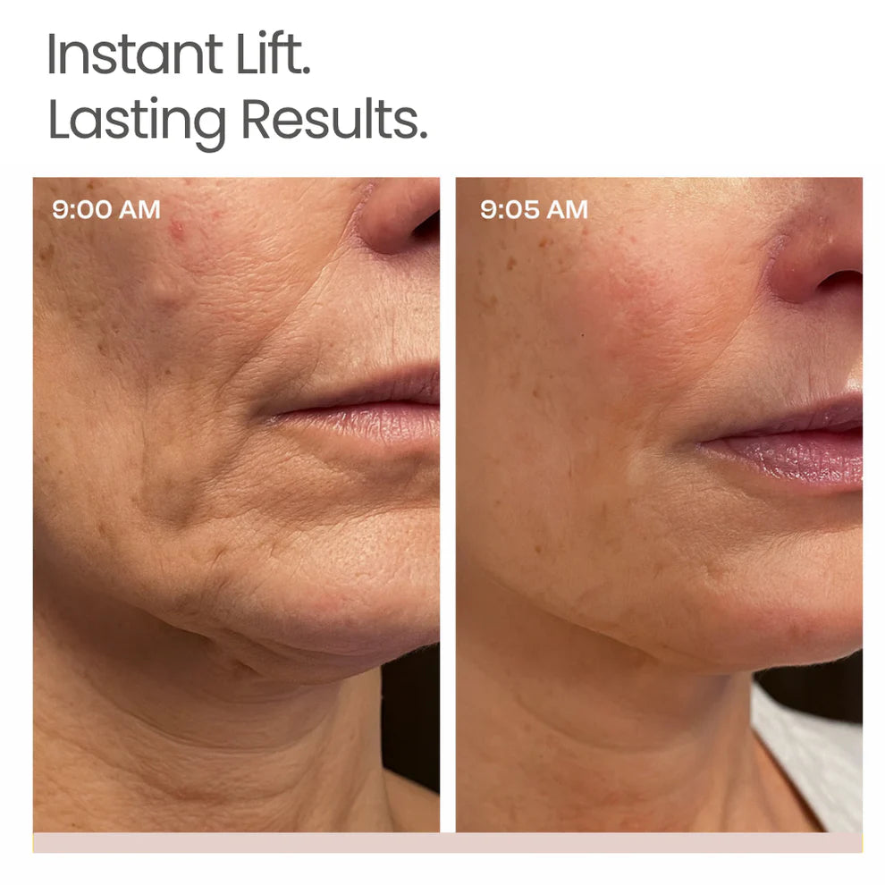 Sereia K-Lift™ Instant Lift Serum
