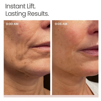 Sereia K-Lift™ Instant Lift Serum