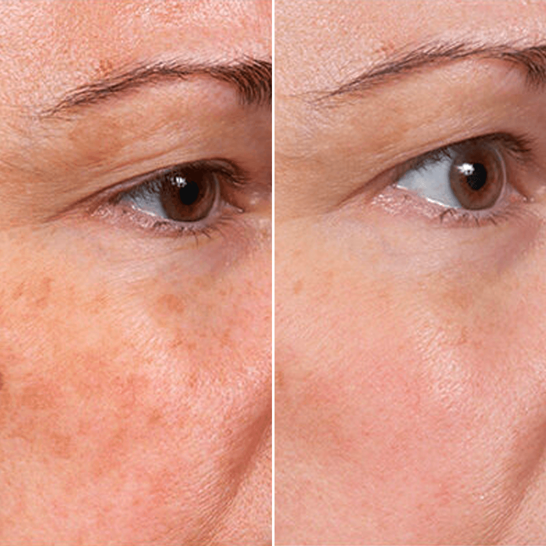 🔥LAST DAY Buy 1 Get 1 Free🔥 Rejuvenate Face Serum