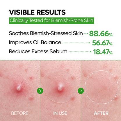 🔥LAST DAY Buy 1 Get 1 Free🔥S-ZINC CLEAR-SKIN Ultra Thin Blemish Spot Patch