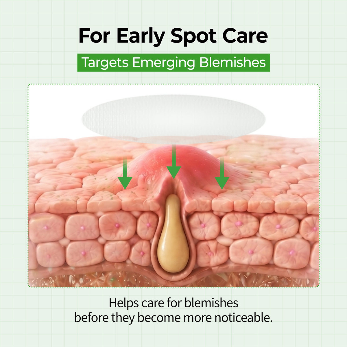 Early stage blemish spot care