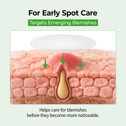 🔥LAST DAY Buy 1 Get 1 Free🔥S-ZINC CLEAR-SKIN Ultra Thin Blemish Spot Patch