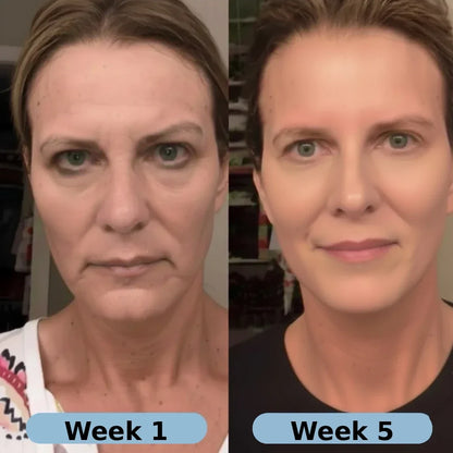 VoluFine | Korean Collagen Serum for Mature Skin