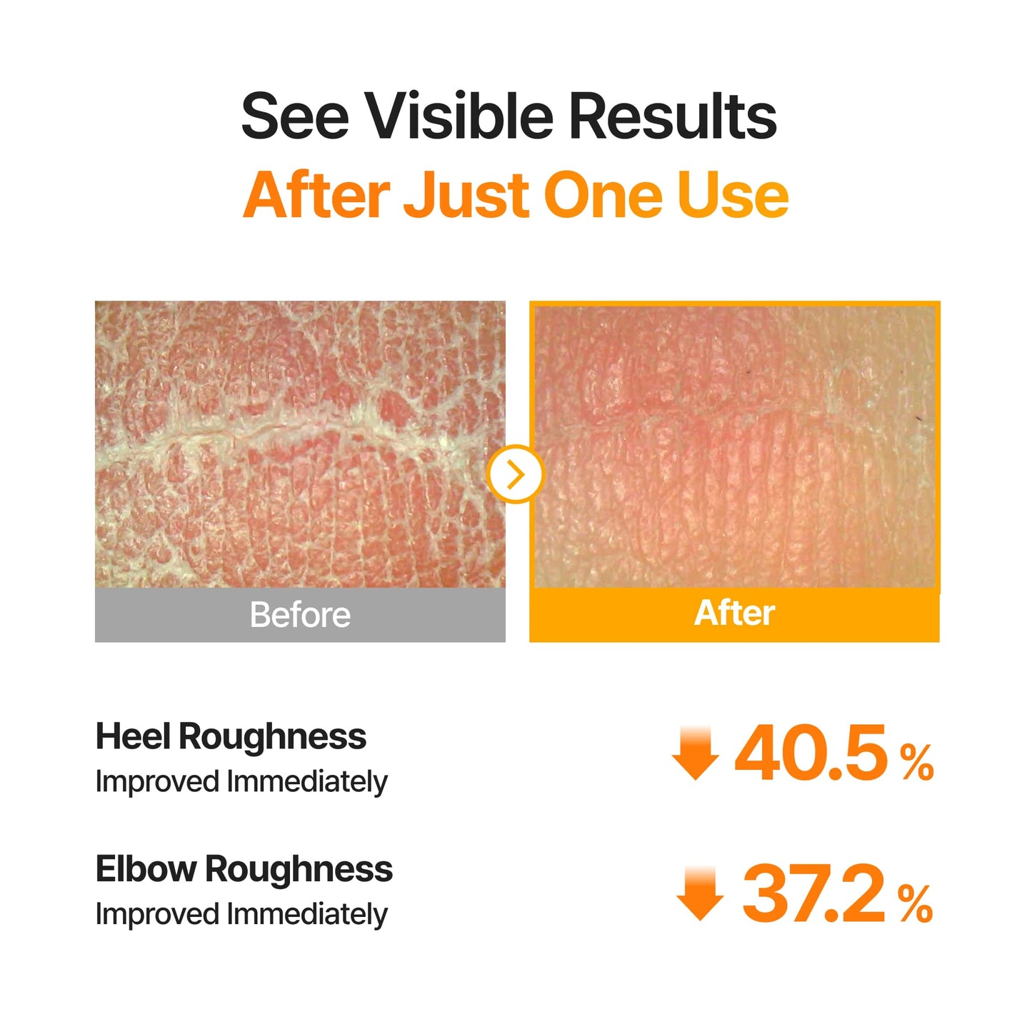 [🔥BOGO☀️Summer Body care Essential☀️] TXA Body Clarifying Pad