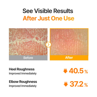 [🔥BOGO☀️Summer Body care Essential☀️] TXA Body Clarifying Pad