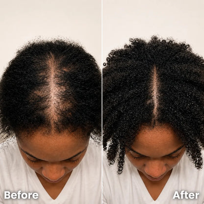 🔥LAST DAY Buy 1 Get 1 Free🔥 Scalp Reset Bar